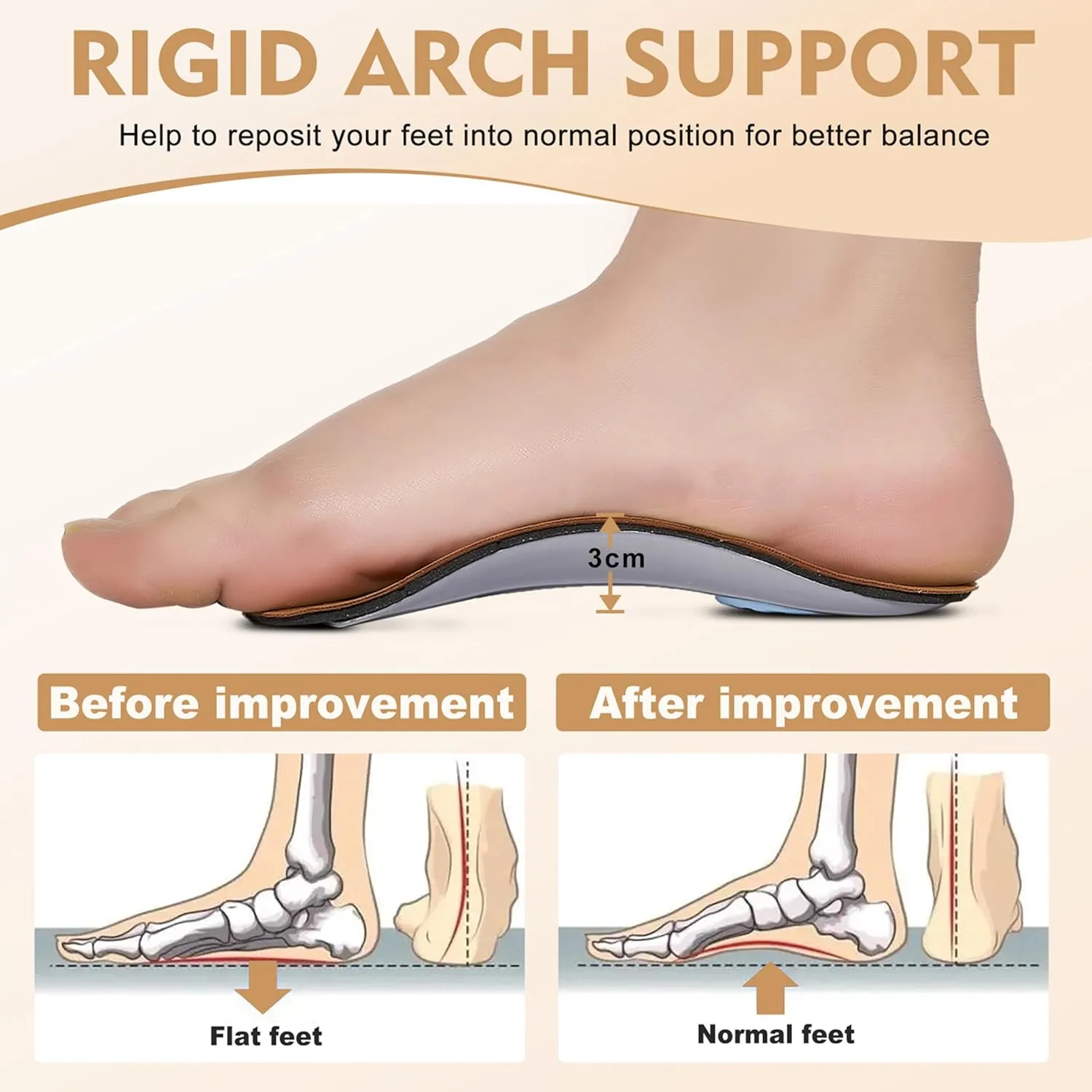 Arch Support Insoles for Women/Men, 3/4 Plantar Fasciitis Insoles High Arch Supports Shoe Insoles for Flat Feet Over-Pronation Foot Pain Relief, Orthotics Heel Cushion Inserts for Running Walking, XL